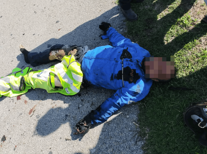 Injured motorcyclist motorcycle caught fire